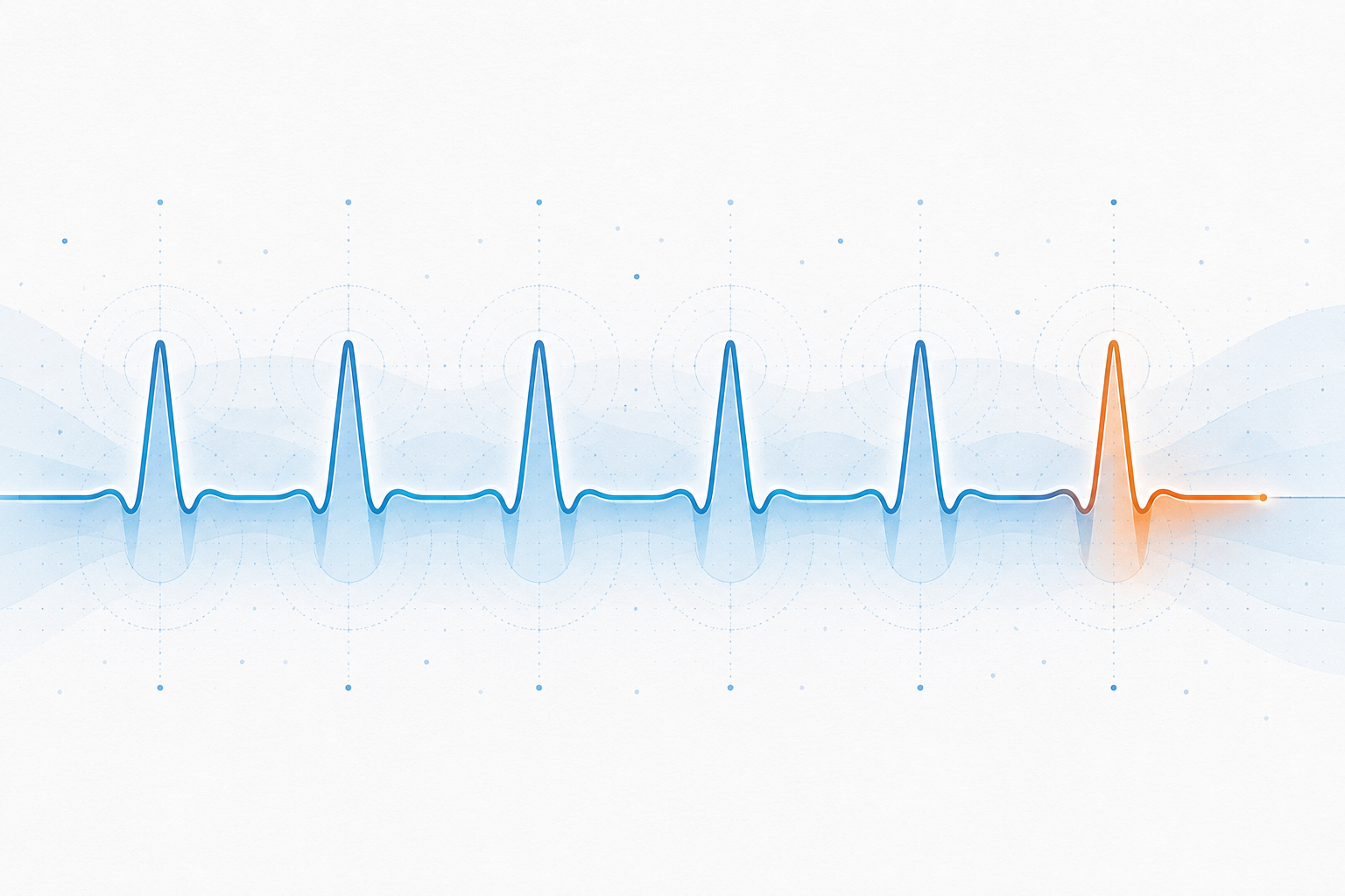Clean editorial data visual showing recurring SaaS revenue as a repeatable pulse.